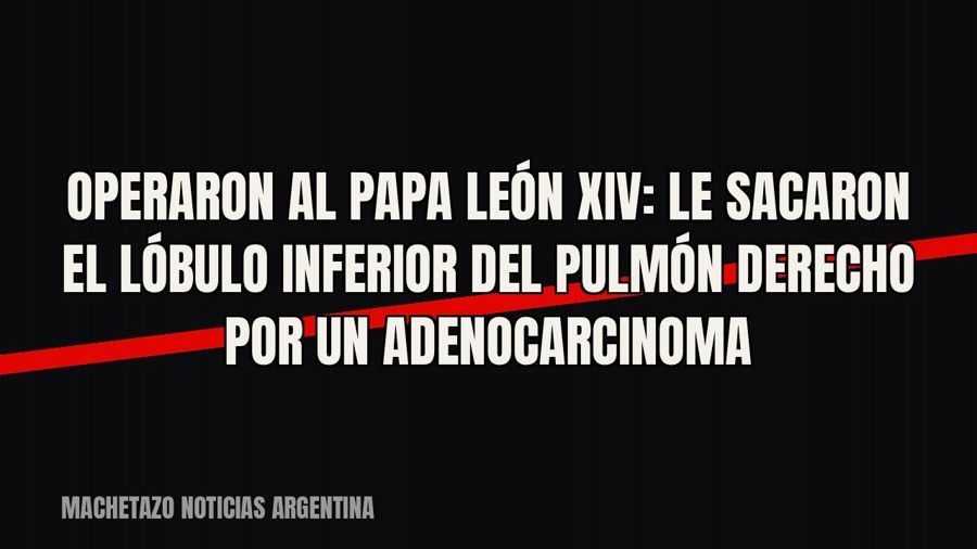Operaron al papa León XIV: le sacaron el lóbulo inferior del pulmón derecho por un adenocarcinoma
