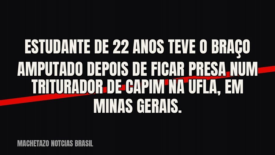 Estudante de 22 anos teve o braço amputado depois de ficar presa num triturador de capim na UFLA, em Minas…