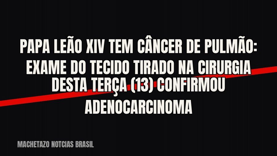Papa Leão XIV tem câncer de pulmão: exame do tecido tirado na cirurgia desta terça (13) confirmou…