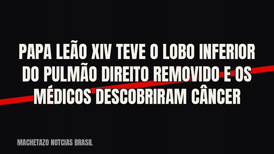 Papa Leão XIV teve o lobo inferior do pulmão direito removido e os médicos descobriram câncer
