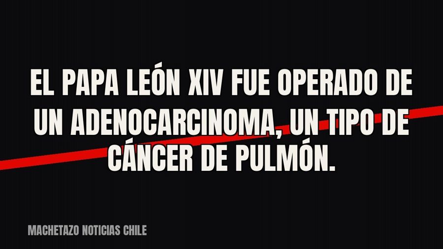 El papa León XIV fue operado de un adenocarcinoma, un tipo de cáncer de pulmón.