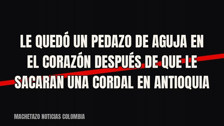 Le quedó un pedazo de aguja en el corazón después de que le sacaran una cordal en Antioquia